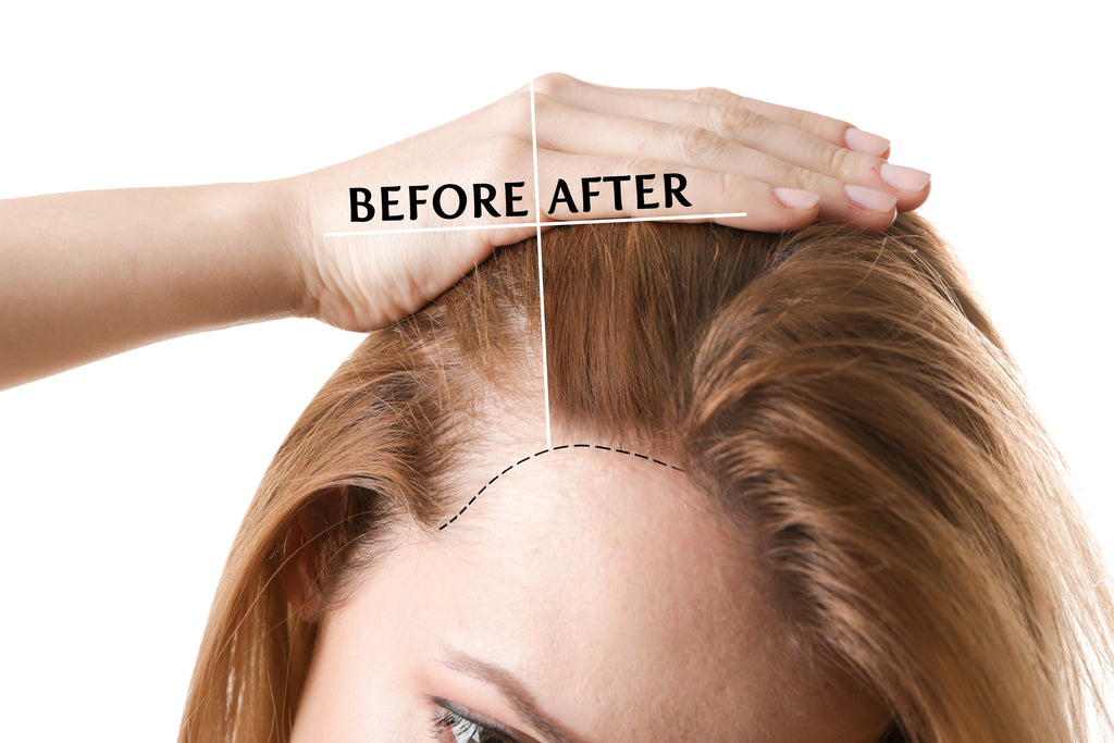 Angel's Hair Loss Set - Treatment & Brush Set for Hair Thinning and Loss - Guardian Angel Naturals